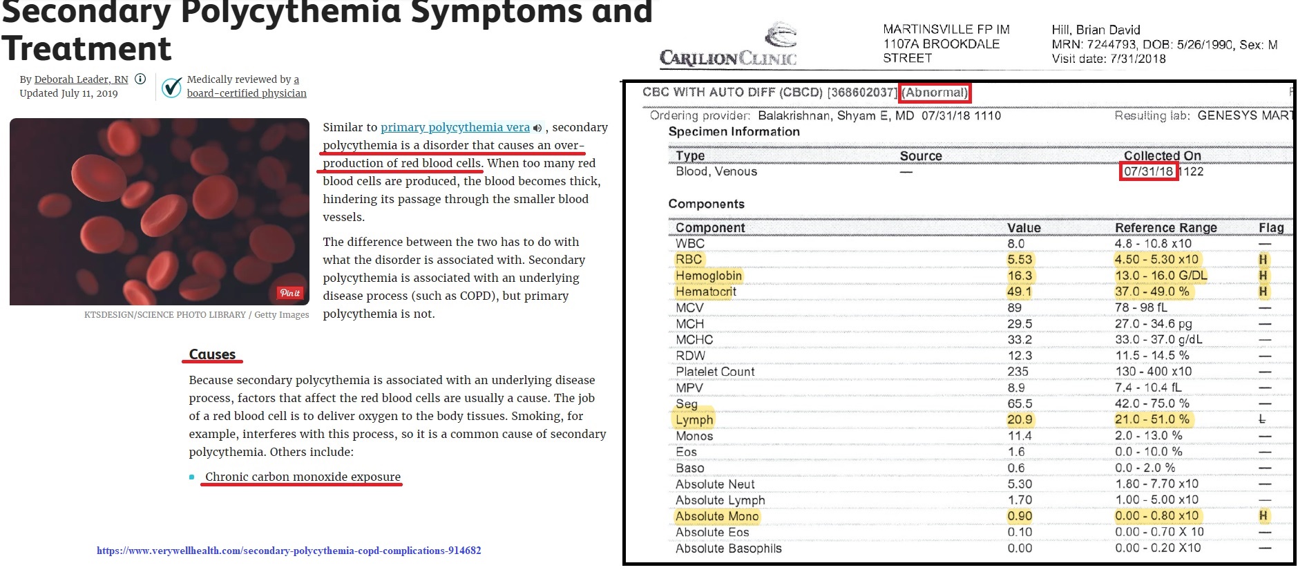 types-and-function-of-white-blood-cells-wbcs